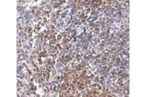 Immunohistochemistry of GPR3 in human spleen tissue with GPR3 antibody at 2. (GPR3 抗体  (C-Term))