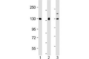 Western blot testing of human 1) U-87 MG, 2) HeLa and 3) BxPC-3 cell lysate with MGEA5 antibody at 1:2000. (MGEA5 抗体  (AA 236-269))