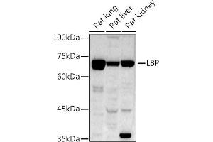 Western blot analysis of extracts of various cell lines, using LBP antibody (ABIN7268285) at 1:1000 dilution. (LBP 抗体)