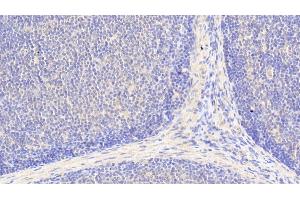 Detection of BCAT1 in Human Lymph node Tissue using Polyclonal Antibody to Branched Chain Aminotransferase 1, Cytosolic (BCAT1) (BCAT1 抗体  (AA 174-386))