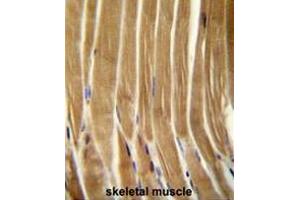 Immunohistochemistry (Paraffin-embedded Sections) (IHC (p)) image for anti-Caspase 5, Apoptosis-Related Cysteine Peptidase (CASP5) (AA 146-175), (Middle Region) antibody (ABIN951054)