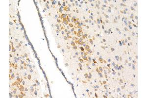 ABIN6257472 and ABIN6274755 at 1/100 staining Mouse brain tissue by IHC-P. (RPS3 抗体  (Internal Region))