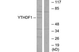Western blot analysis of extracts from 293 cells, using YTHDF1 Antibody. (YTHDF1 抗体  (AA 1-50))