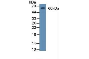 Detection of CD55 in Rat Brain Tissue using Polyclonal Antibody to Cluster Of Differentiation 55 (CD55) (CD55 抗体  (AA 35-285))