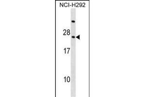 RARRES3 Antibody (Center) (ABIN1538411 and ABIN2850262) western blot analysis in NCI- cell line lysates (35 μg/lane). (RARRES3 抗体  (AA 43-71))