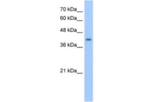 Western Blotting (WB) image for anti-ACC Synthase-Like Protein 1 (ACCS) antibody (ABIN2463243) (PHACS 抗体)