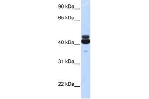 GNA15 antibody used at 1 ug/ml to detect target protein.