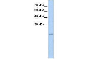 WB Suggested Anti-RFPL3 Antibody Titration:  5. (RFPL3 抗体  (Middle Region))
