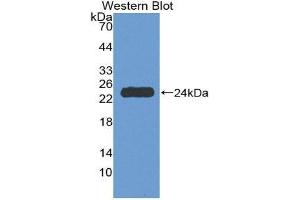 Western Blotting (WB) image for anti-Tumor Necrosis Factor Receptor Superfamily, Member 1A (TNFRSF1A) (AA 248-428) antibody (ABIN1980533) (TNFRSF1A 抗体  (AA 248-428))