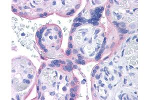 Immunohistochemistry (IHC) image for anti-Insulin Receptor (INSR) (Middle Region) antibody (ABIN2792204) (Insulin Receptor 抗体  (Middle Region))