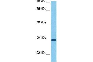 Host:  Rabbit  Target Name:  SNAI1  Sample Tissue:  Human Stomach Tumor  Antibody Dilution:  1ug/ml (SNAIL 抗体  (N-Term))