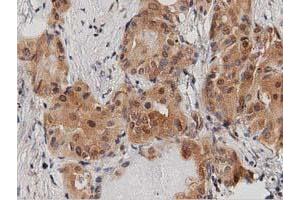 Immunohistochemical staining of paraffin-embedded Human Kidney tissue using anti-DNAJA2 mouse monoclonal antibody. (DNAJA2 抗体)