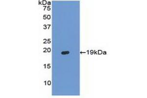 Detection of Recombinant HBa1, Bovine using Polyclonal Antibody to Hemoglobin Alpha 1 (HBa1) (HBA1 抗体  (AA 2-142))