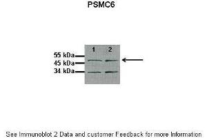 Lanes:  1: 10ug proteasome fraction from C57B1/6J mouse brain, 2: 10ug proteasome fraction from BLAB/C mouse brain Primary Antibody Dilution:  1:500 Secondary Antibody:  Anti-rabbit HRP Secondary Antibody Dilution:  1:5000 Gene Name:  PSMC6 Submitted by:  Dr.