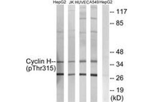 Western blot analysis of extracts from HepG2 cells, Jurkat cells, HuvEc cells and A549 cells, using Cyclin H (Phospho-Thr315) Antibody. (Cyclin H 抗体  (pThr315))