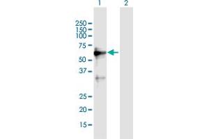 Western Blot analysis of ZNF554 expression in transfected 293T cell line by ZNF554 MaxPab polyclonal antibody. (ZNF554 抗体  (AA 1-538))