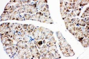 Anti-IGF1 Receptor antibody, IHC(P) IHC(P): Rat Pancreas Tissue (IGF1R 抗体  (C-Term))