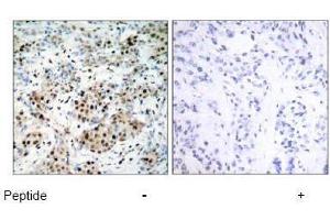 Image no. 1 for anti-cAMP Responsive Element Binding Protein 1 (CREB1) (Ser133) antibody (ABIN197188) (CREB1 抗体  (Ser133))