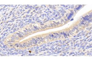 Detection of CA125 in Mouse Uterus Tissue using Polyclonal Antibody to Carbohydrate Antigen 125 (CA125) (MUC16 抗体  (AA 2-258))