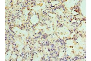 Immunohistochemistry of paraffin-embedded human lung tissue using ABIN7143352 at dilution of 1:100 (Adenylosuccinate Lyase 抗体  (AA 1-310))