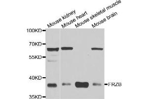 Western blot analysis of extracts of various cell lines, using FRZB antibody (ABIN5973961) at 1/1000 dilution. (FRZB 抗体)