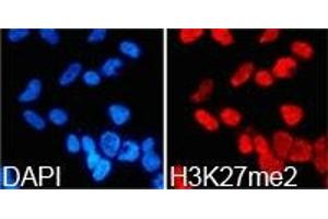 Immunofluorescence analysis of 293T cell using H3K27me2 antibody. (Histone 3 抗体  (H3K27me2))