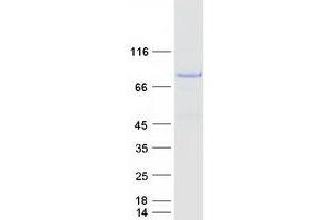 Validation with Western Blot (NUMB Protein (Transcript Variant 1) (Myc-DYKDDDDK Tag))