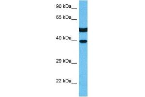 Host:  Mouse  Target Name:  MAPK14  Sample Tissue:  Mouse Kidney  Antibody Dilution:  1ug/ml (MAPK14 抗体  (C-Term))