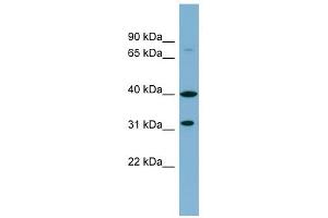C9ORF4 antibody used at 1 ug/ml to detect target protein. (Ferric-Chelate Reductase 1 Like (FRRS1L) (Middle Region) 抗体)