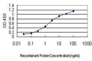 Detection limit for recombinant GST tagged C6orf139 is approximately 0. (CENPQ 抗体  (AA 1-268))
