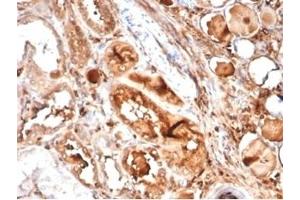 Formalin-fixed, paraffin-embedded human kidney stained with MICA Mouse Recombinant Monoclonal Antibody (MICA/4442). (MICA 抗体  (AA 1-200))