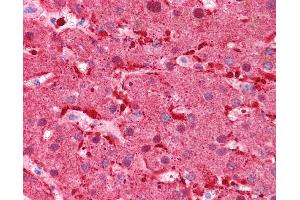 Immunohistochemistry (IHC) image for anti-Fatty Acid Binding Protein 1, Liver (FABP1) (N-Term) antibody (ABIN502840) (FABP1 抗体  (N-Term))