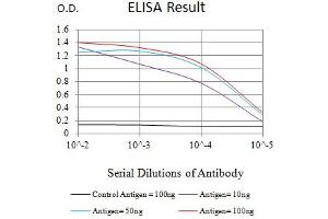 Black line: Control Antigen (100 ng),Purple line: Antigen (10 ng), Blue line: Antigen (50 ng), Red line:Antigen (100 ng) (IL4 Receptor 抗体  (AA 26-232))