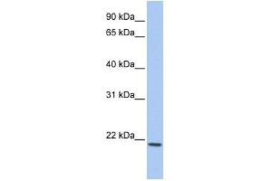WB Suggested Anti-IL22 Antibody Titration:  0. (IL-22 抗体  (C-Term))