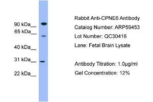WB Suggested Anti-CPNE6  Antibody Titration: 0. (CPNE6 抗体  (Middle Region))
