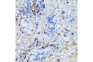Immunohistochemistry of paraffin-embedded rat spleen using CD209 Rabbit mAb (ABIN7266173) at dilution of 1:100 (40x lens). (DC-SIGN/CD209 抗体)