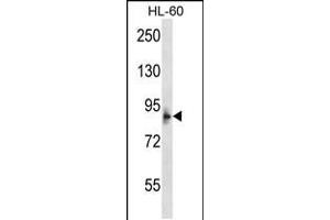 Western blot analysis in HL-60 cell line lysates (35ug/lane). (MCPH1 抗体  (N-Term))