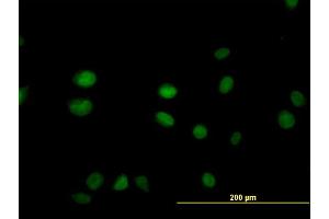 Immunofluorescence of monoclonal antibody to SGK2 on HeLa cell. (SGK2 抗体  (AA 293-367))