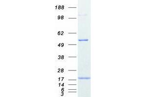 Western Blotting (WB) image for Profilin 2 (PFN2) (Transcript Variant 1) protein (Myc-DYKDDDDK Tag) (ABIN2729685)