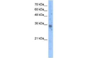 Western Blotting (WB) image for anti-Solute Carrier Family 25 (Mitochondrial Carrier, Graves Disease Autoantigen), Member 16 (SLC25A16) (N-Term) antibody (ABIN630321)