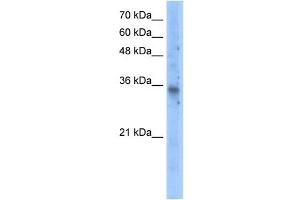 SLC25A16 antibody used at 5 ug/ml to detect target protein. (SLC25A16 抗体  (N-Term))