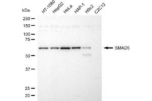 Western blotting analysis using SMAD5 antibody (ABIN7800376).