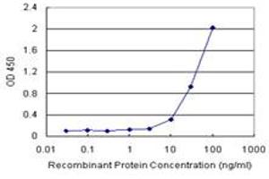 FABP4 (Human) Matched Antibody Pair