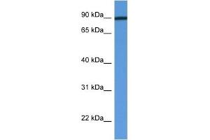 Western Blot showing PFKM antibody used at a concentration of 1 ug/ml against Fetal Heart Lysate (PFKM 抗体  (C-Term))
