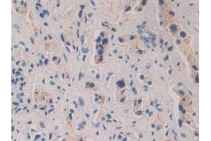 Immunohistochemistry (IHC) image for anti-Sema Domain, Immunoglobulin Domain (Ig), Short Basic Domain, Secreted, (Semaphorin) 3A (SEMA3A) (AA 580-664) antibody (ABIN7430102)