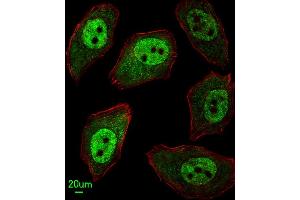 Immunofluorescent analysis of  cells, using EX2 Antibody (Center) 8975c. (APEX2 抗体  (AA 143-171))