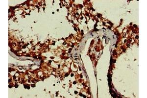 Immunohistochemistry of paraffin-embedded human testis tissue using ABIN7150470 at dilution of 1:100 (CRCP 抗体  (AA 1-115))