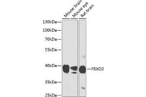Western blot analysis of extracts of various cell lines, using FBXO2 antibody (ABIN6130381, ABIN6140514, ABIN6140515 and ABIN6224682) at 1:1000 dilution. (FBXO2 抗体  (AA 1-296))