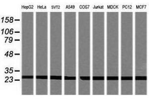 Image no. 2 for anti-Proteasome Subunit alpha 2 (PSMA2) (AA 50-234) antibody (ABIN1491568) (PSMA2 抗体  (AA 50-234))