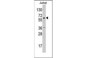 Western blot analysis using AP14221PU-N CYP19A1 antibody in Jurkat cell line lysates (35 µg/lane). (Aromatase 抗体  (C-Term))